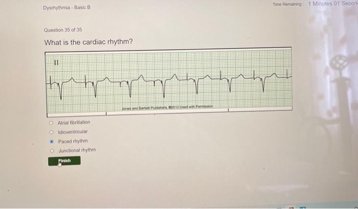 Relias dysrhythmia basic a 35 questions