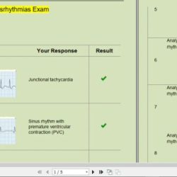 Relias dysrhythmia basic a 35 questions