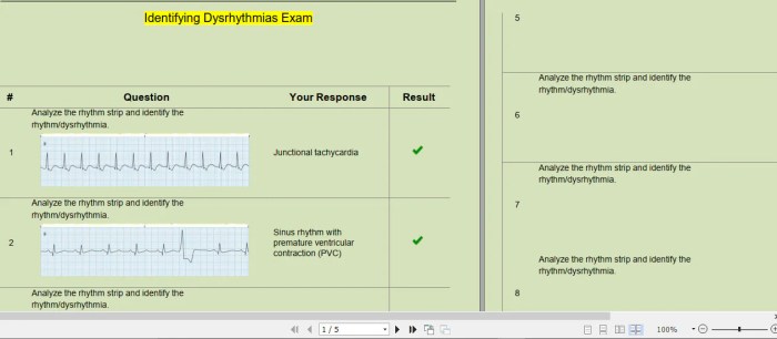 Relias dysrhythmia basic a 35 questions