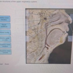 Assignment 6.1 upper respiratory tract labeling