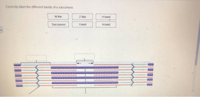 Muscle sarcomere myosin line disc filaments band skeletal actin contraction where physiology zone austincc edu muscles anatomy review anchored nursing